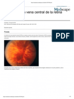 7.1 Central Vein Occlusion - Emedicine