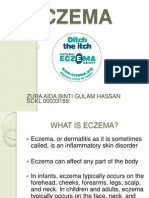 Eczema