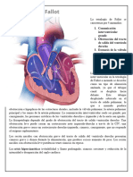 Tetralogía de Fallot