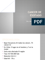 Cancer de Esofago