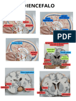 Diencefalo y Telencefalo 20231128 112033 0000