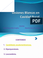 Lesiones Blancas en Cavidad Bucal