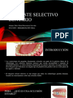 Desgaste Selectivo Dentario Oclusion