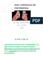 Arritmia Cardiaca