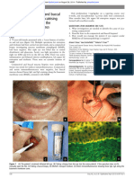 Como Realizar Una Biopsia en Penfigoide Ocular