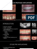 Cours Implant Dentaire