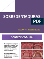 Semana 14 - Sobredentaduras Fin