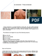 Pityriasis Versicolor