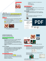 Rehabilitación Post - Tratamiento Pulpar Coronas de Acero