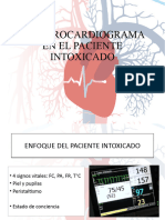 ECG Tóxico