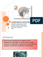 Tumores Hipofisiarios