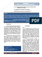 Different Approaches To Complicated Crown Root Fractures in Primary Teeth