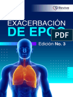 01 Ebook - Exacerbación de Epoc