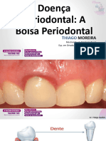 03 - Bolsa Periodontal