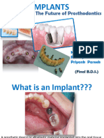 Implant