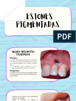 Lesiones Pigmentadas