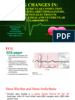 ECG Changes