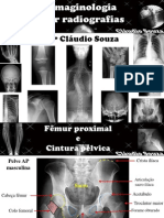 Aula 4 - Imaginologia Por Radiografias - Femur e Cintura Pelvica. Profº Claudio Souza