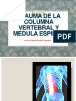 Trauma Medular