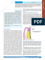 Biologic Width Considering Periodontium