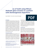 DENTINOGENESIS IMPERFECTA Edelhoff - Brix - Schweiger Dentinogenesis Imperfecta Clinical Case