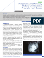 ALO Subclinical Rheumatic Heart Disease