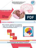 Edemacerebral