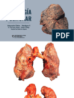 Patología Pulmonar