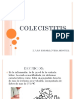 COLECISTITIS