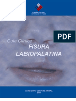 Guian Minsal Fisura Labiopalatina