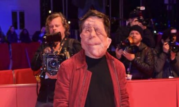 El actor Adam Pearson en la alfombra roja del festival de cine de Berlín.