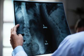 Person Holding X-ray Film