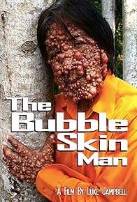 Primary photo for The Bubble Skin Man