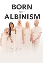 Born with Albinism (2021)