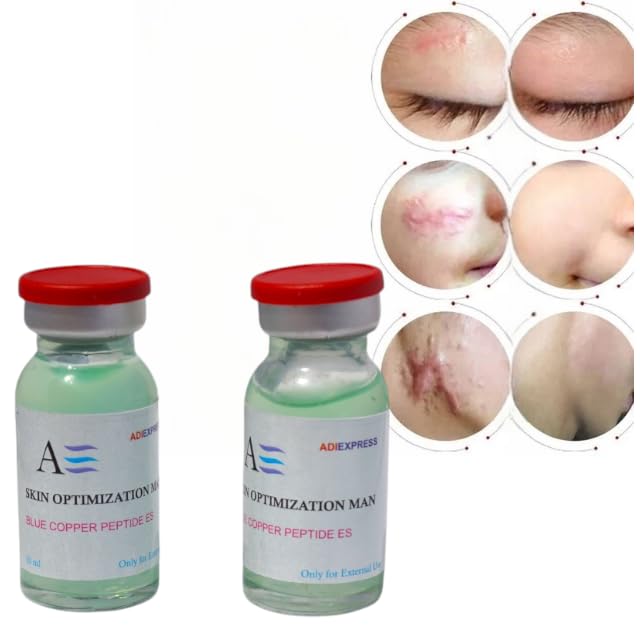 Burn scar removal cream for face body old scars accident scar injury scar injury spots pimple marks for men women.