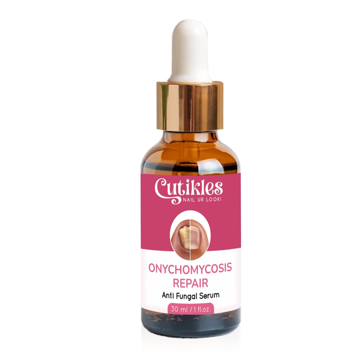 CUTIKLES Anti-Fungal Nail Serum for Nail Growth & Repair. Professional Formula, 100% Pure. Nourishes Nails & Helps Remedy Fungal Nail Infection, Damaged Nails & Ingrown Toe-Nail - 30ml