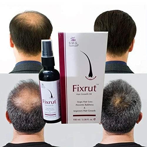 S.M.G. HEALTHCARE Fixrut Hair Growth Oil 100 ml