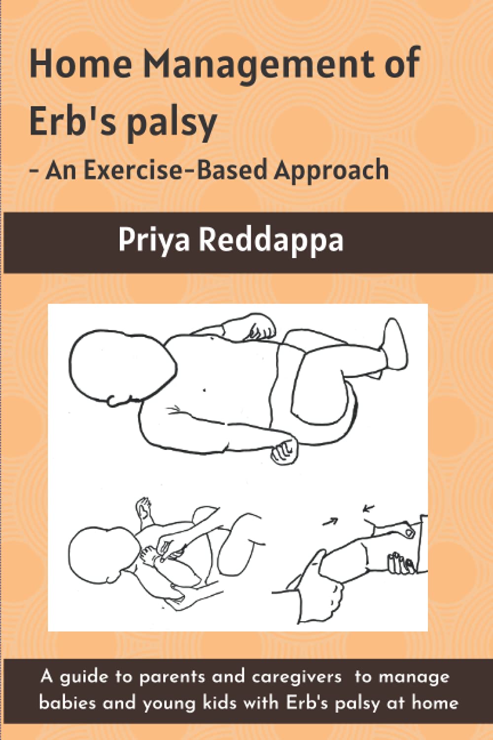 Home Management of Erb's Palsy - An Exercise-Based Approach: A guide to parents and caregivers to manage babies and young kids with Erb's palsy at home