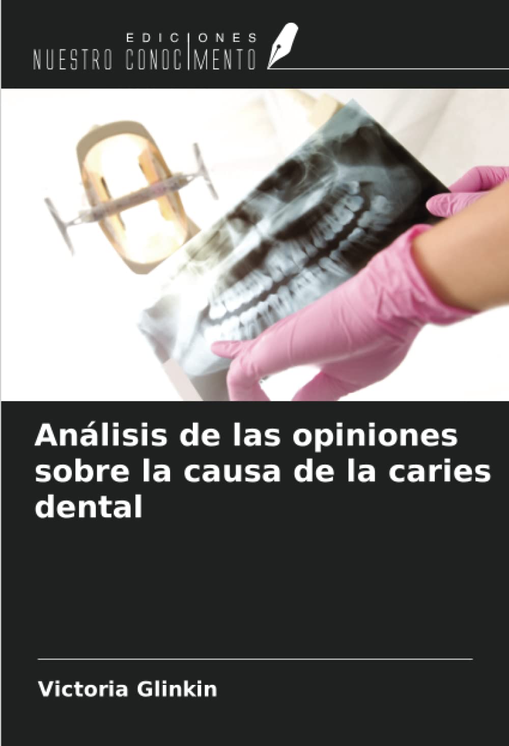 Análisis de las opiniones sobre la causa de la caries dental (Spanish Edition)