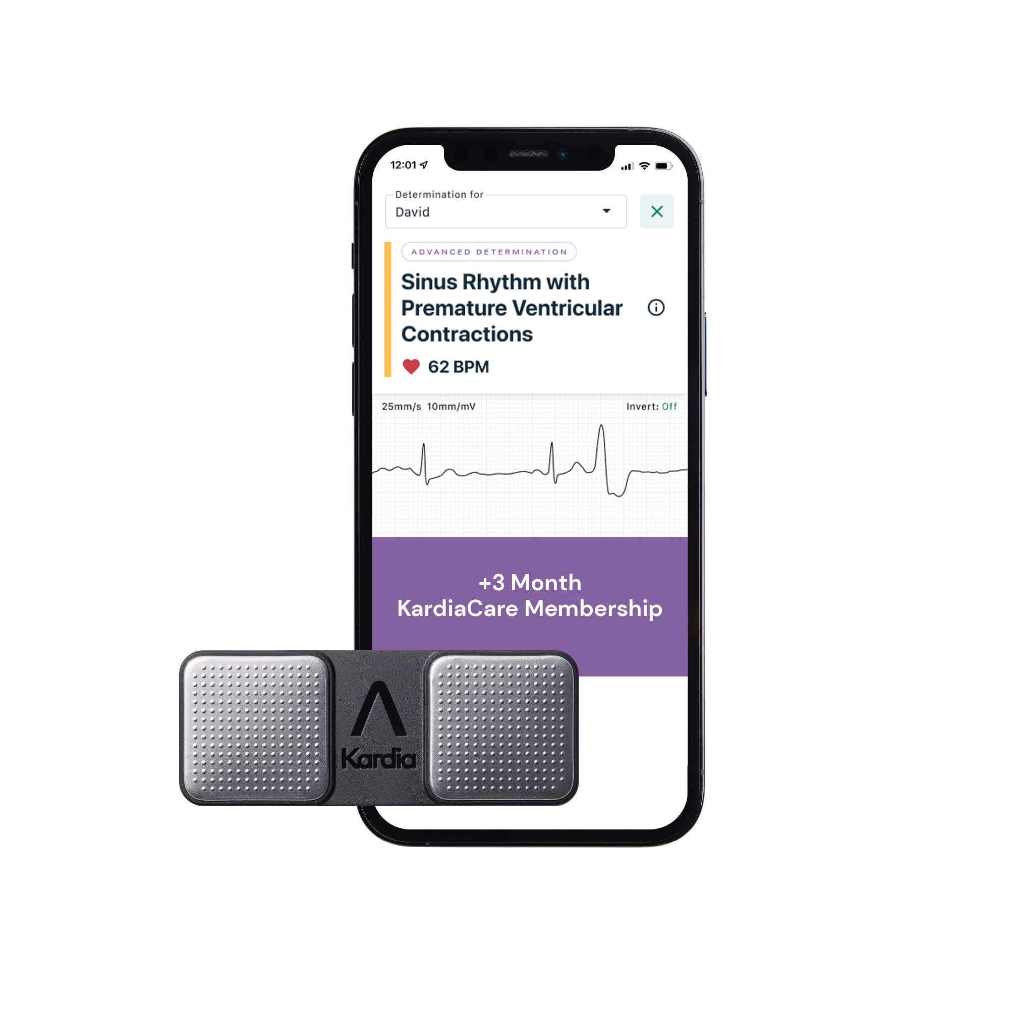 AliveCor KardiaMobile Personal ECG Monitor + 1 Year KardiaCare, 3 Additional Arrhythmia Detections, Smartphone Compatible Heart Monitor