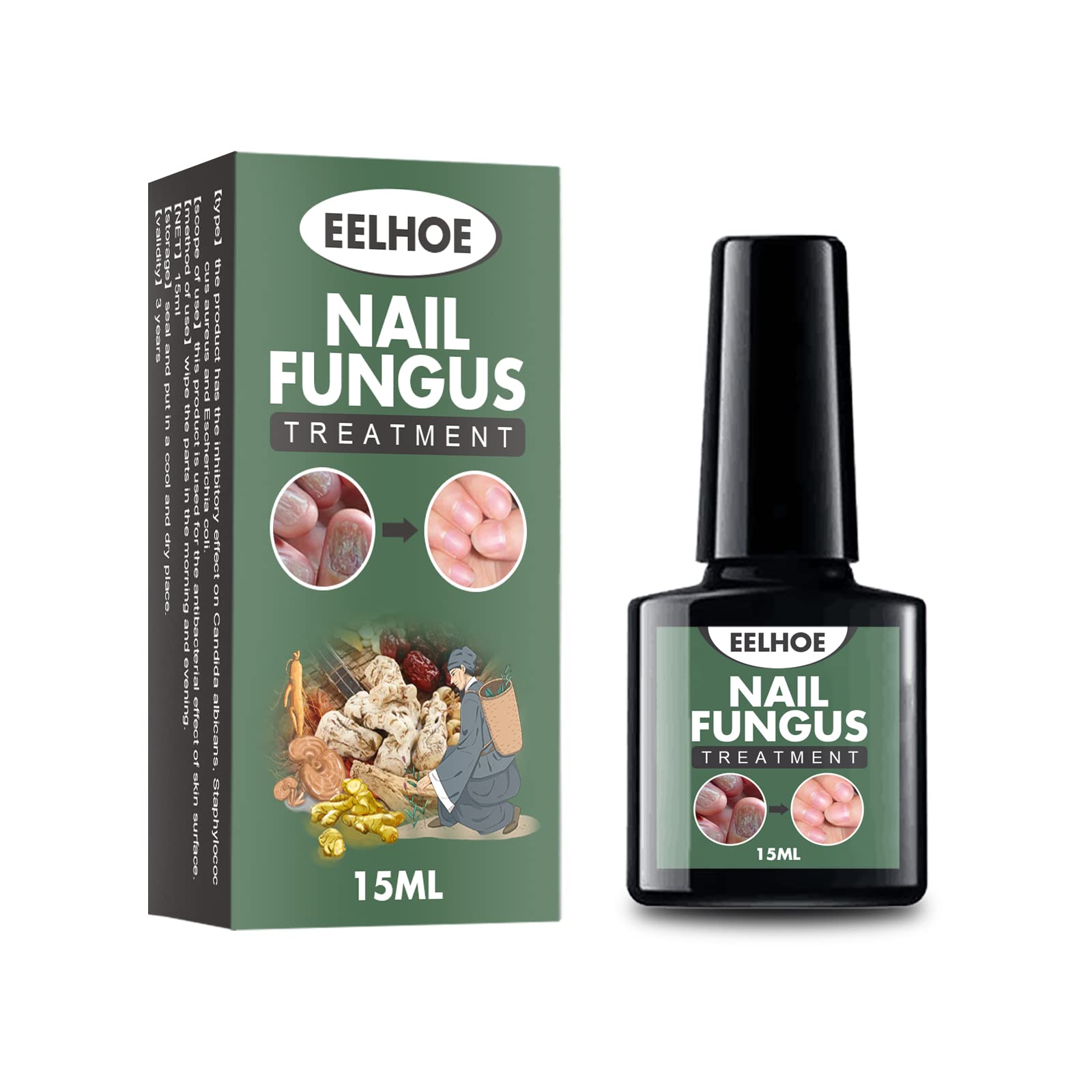 Toenail Fungus Treatment, Ingrown Toenails Treatment, Toenail Fungus Treatment,Fungal Nail Renewal,Ingrown Toenail Treatment