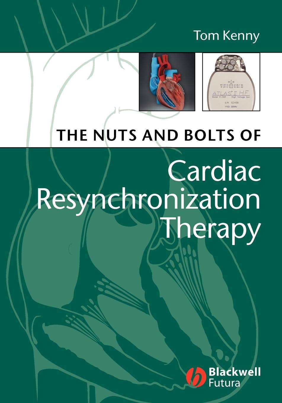 The Nuts and Bolts of Cardiac Resynchronization Therapy: 2 (Nuts and Bolts Series (Replaced by 5113))