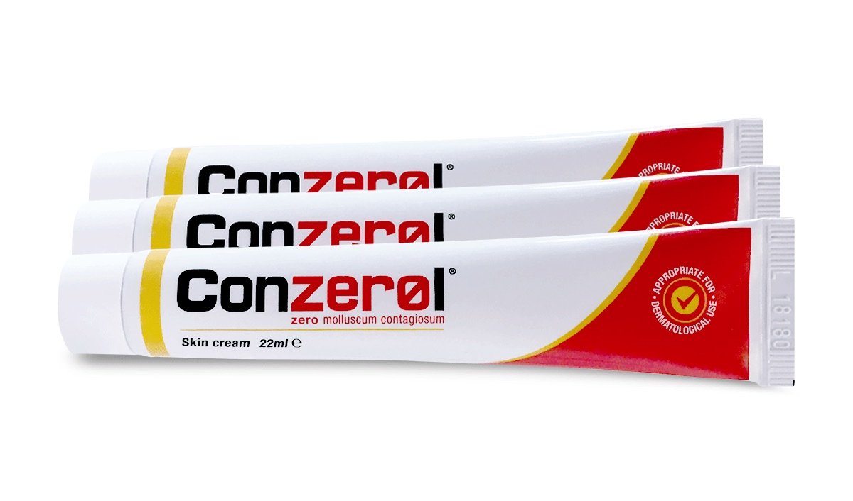 Conzerol. 3 Creams Molluscum Solution Kit