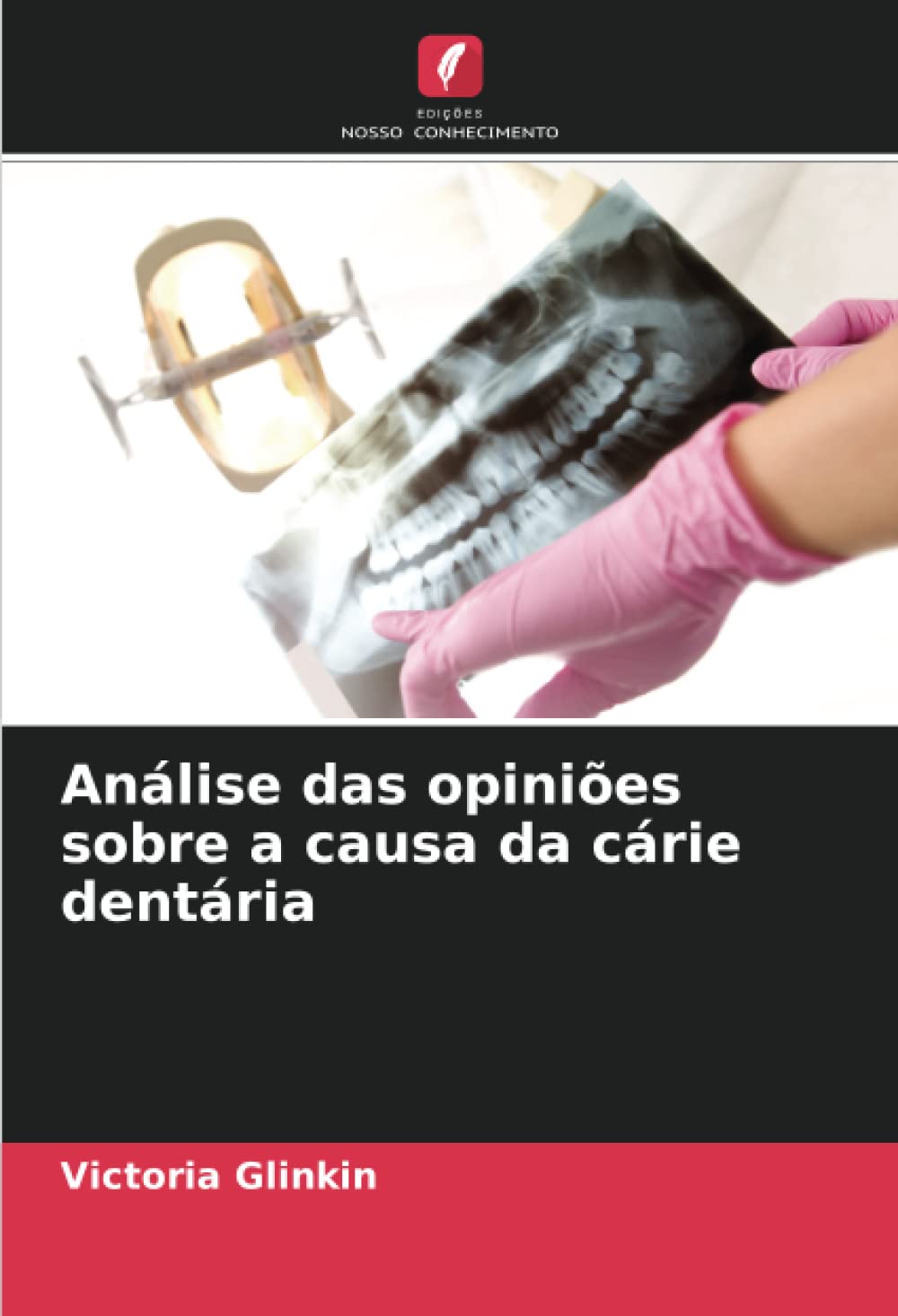 Análise das opiniões sobre a causa da cárie dentária (Portuguese Edition)