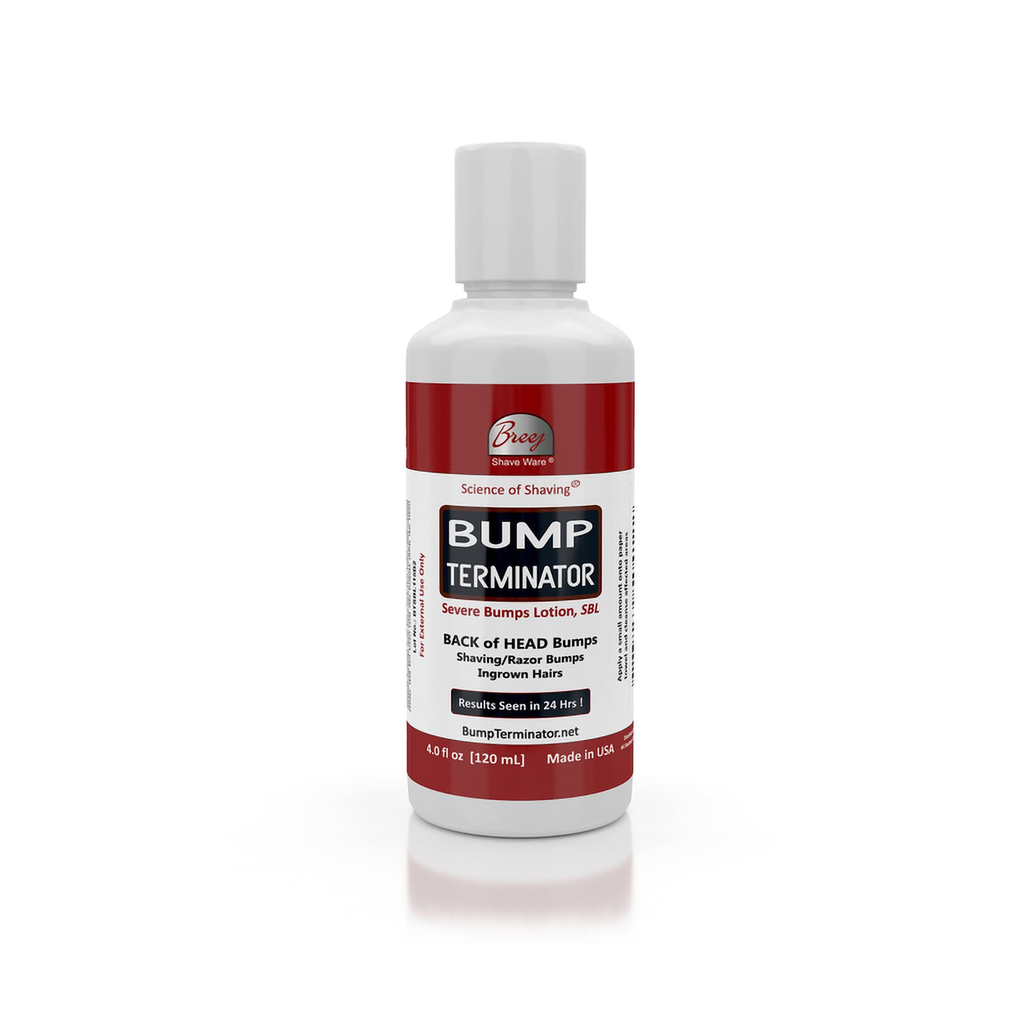 BREEJBump Terminator Severe Bumps Lotion (4oz)