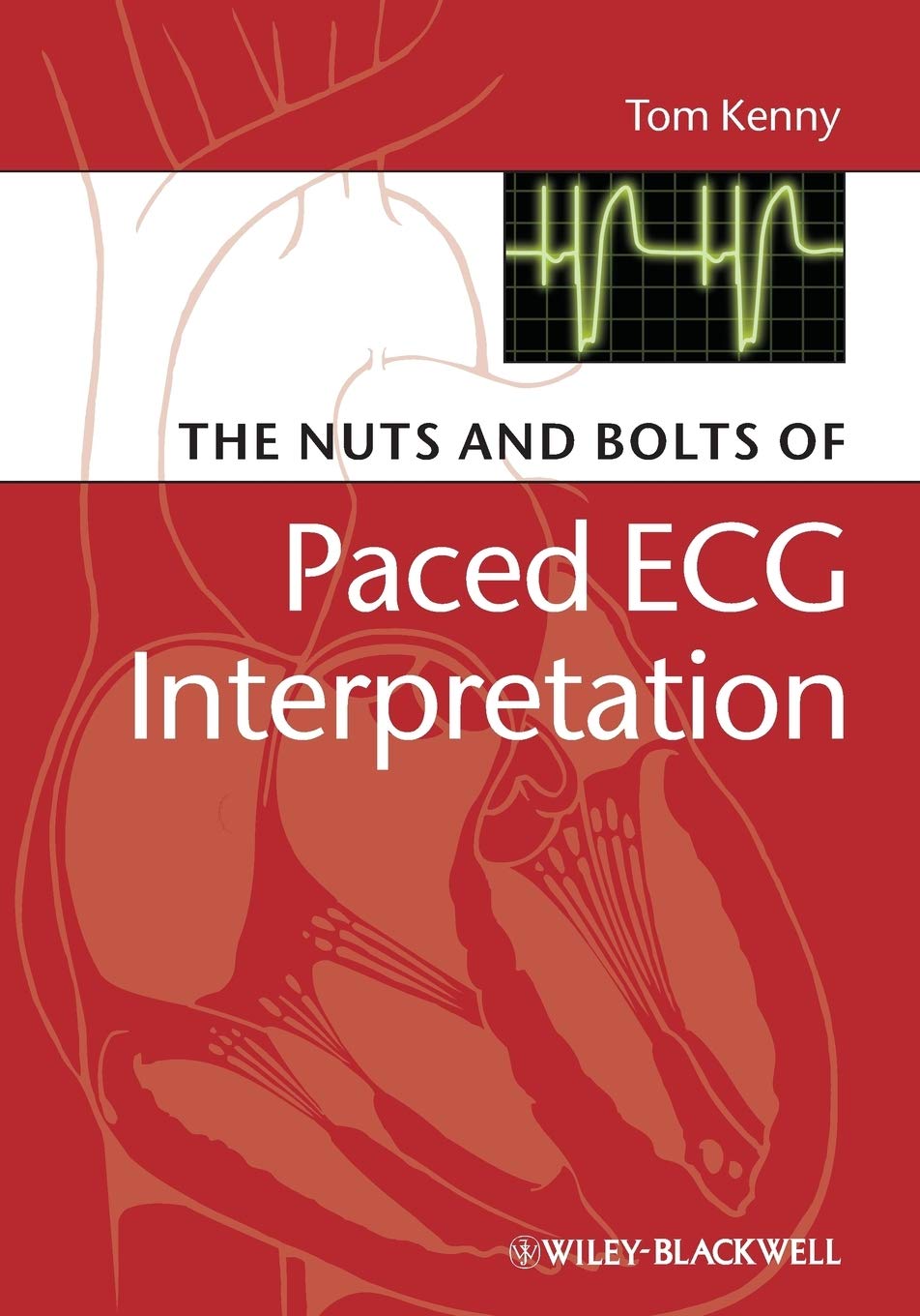 The Nuts and bolts of Paced ECG Interpretation 1st Edition