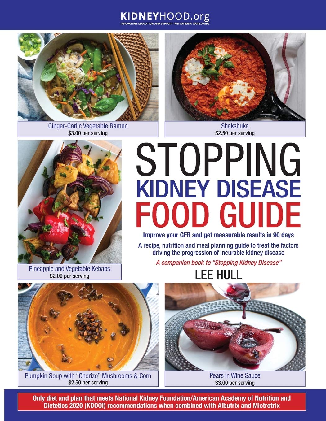 Stopping Kidney Disease Food Guide: A recipe, nutrition and meal planning guide to treat the factors driving the progression of incurable kidney disease Paperback – Illustrated, 25 Mar. 2022