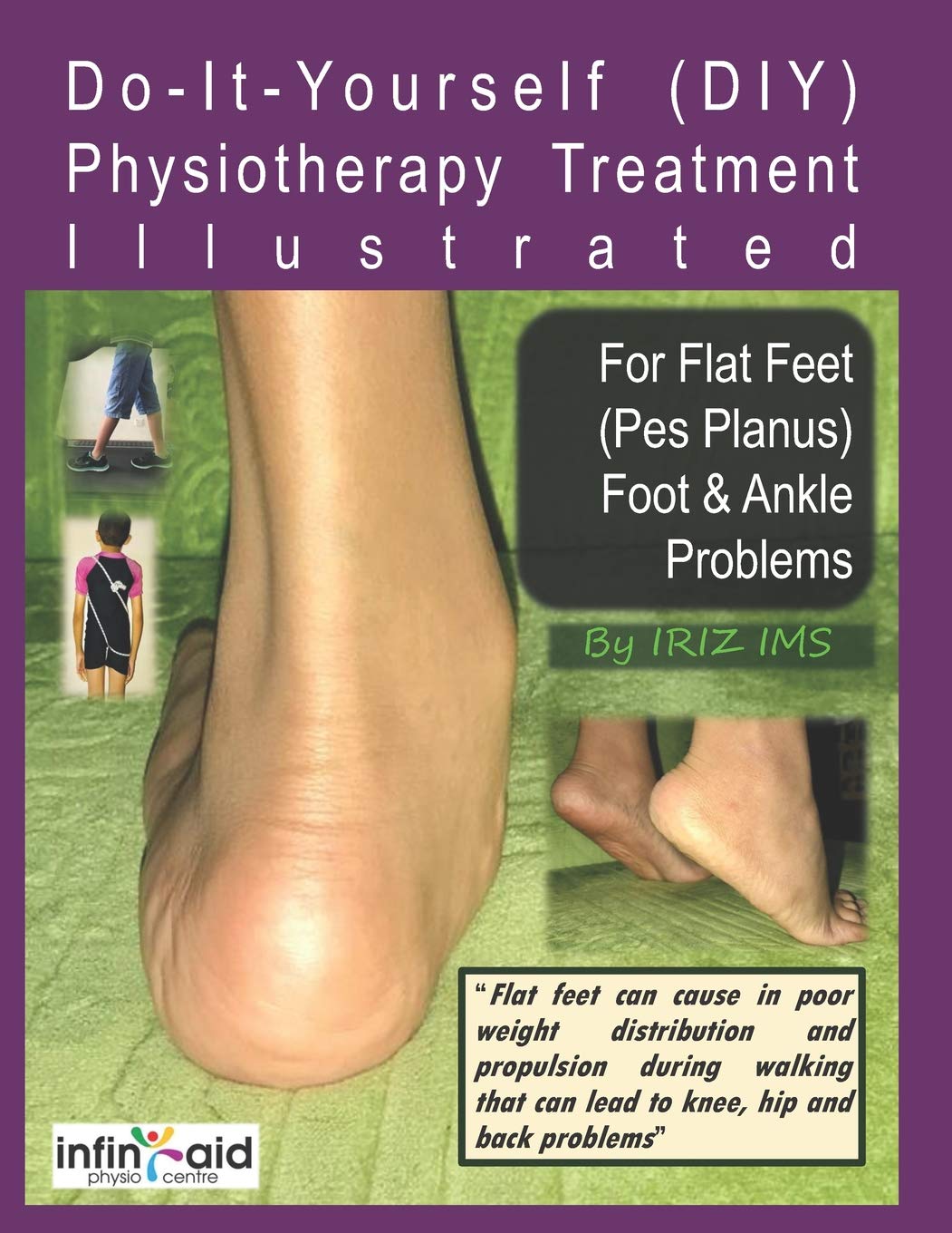 Physiotherapy Treatment Illustrated For Flat Feet (Pes Planus) Foot & Ankle Problems (Iriz_self_help) Paperback – December 10, 2017