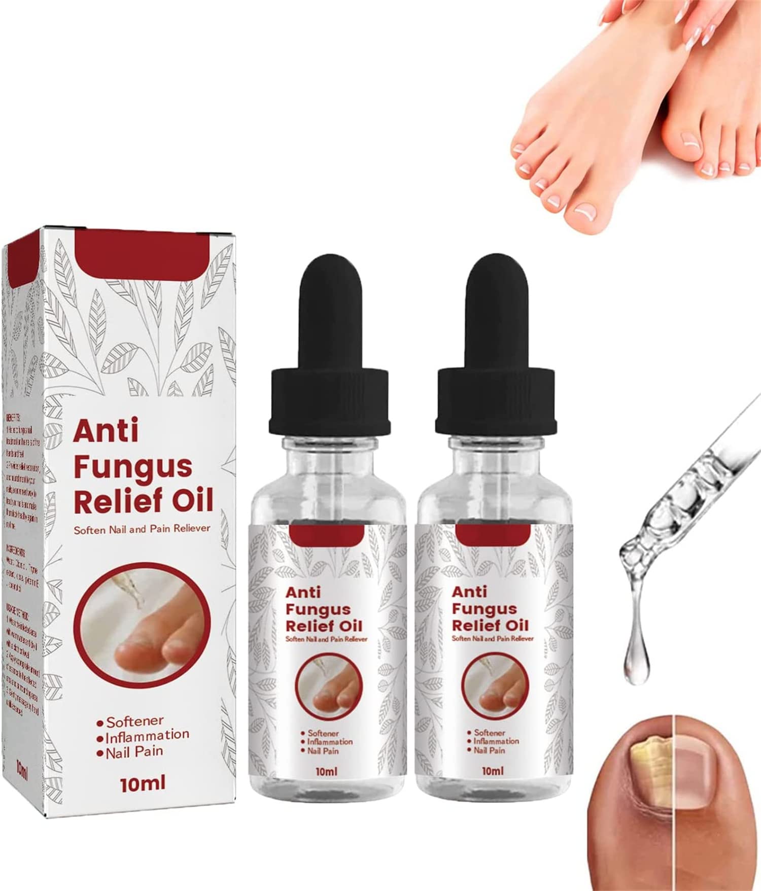 Onychomycosis Rapid Relief Oil,Onychomycosis Nail Treatment,Toenail Repair For Damaged Nails,Promotes The Growth of Healthier,Strong Nails (2 Pcs)