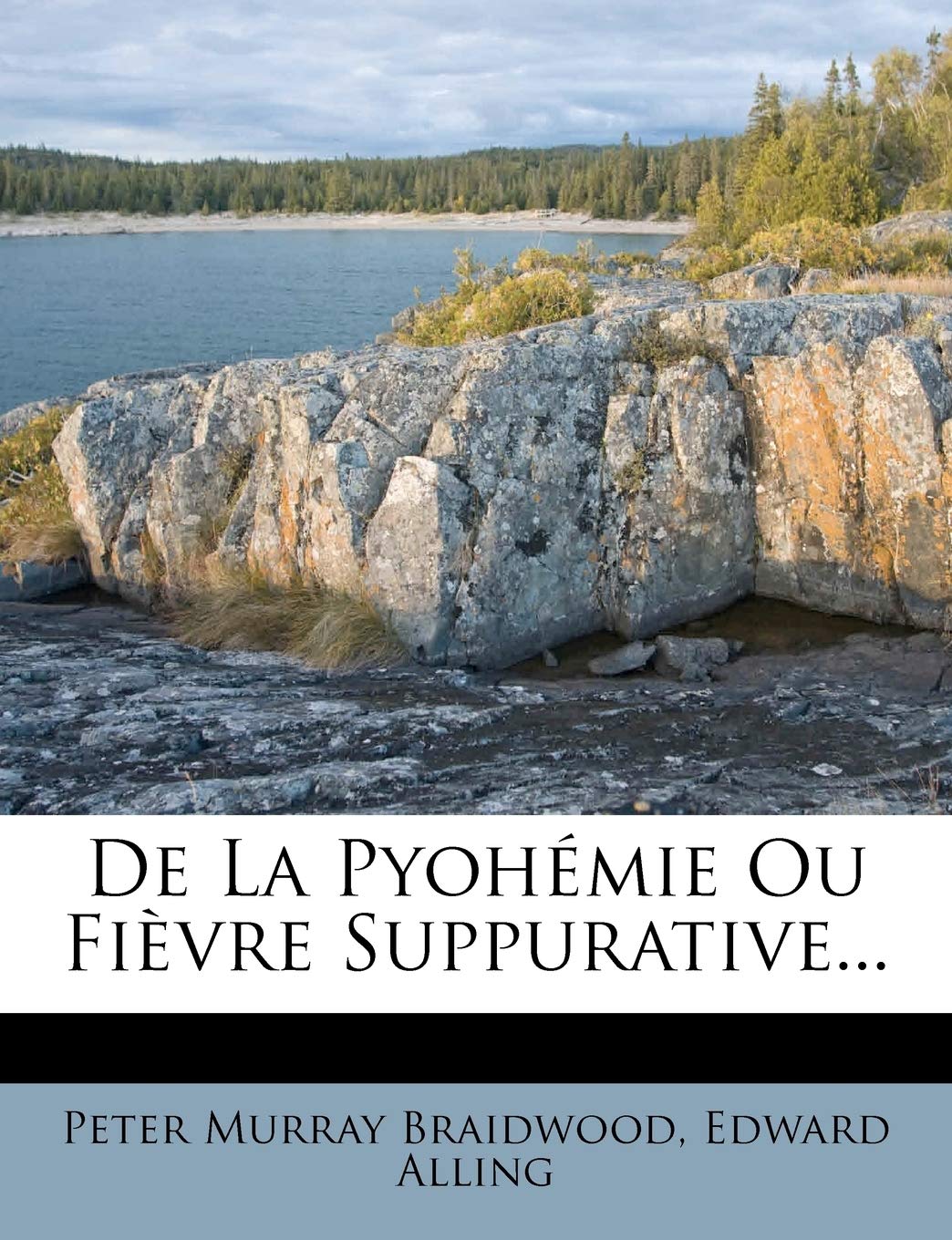 De La Pyohémie Ou Fièvre Suppurative...